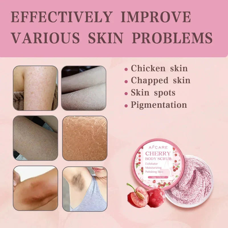 Cherry Body Scrub Exfoliator Deep Cleaning Moisturizing Niacinamide Whitening Improve Cracked Chicken Skin Exfoliating Cream