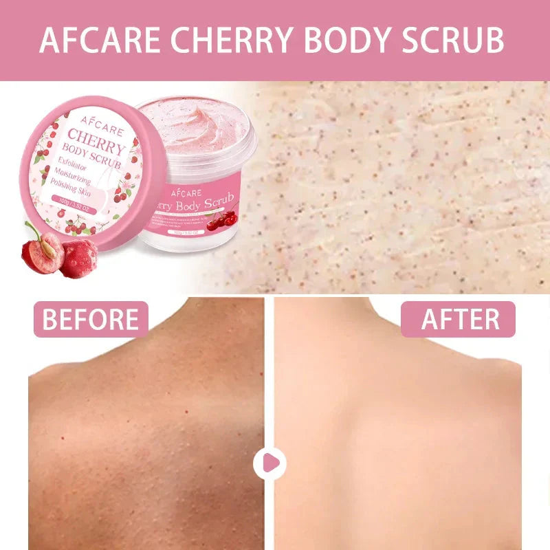 Cherry Body Scrub Exfoliator Deep Cleaning Moisturizing Niacinamide Whitening Improve Cracked Chicken Skin Exfoliating Cream
